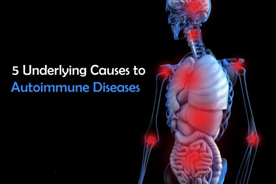 Natural Medicine and Autoimmune – 5 Underlying Causes